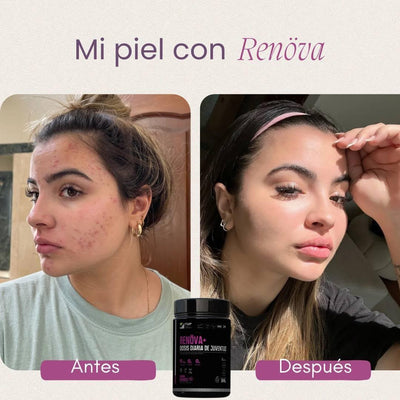 La piel de una clienta